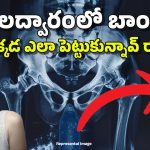 Bomb in Rectum: వీడెవడండి బాబు.. ఏకంగా బాంబునే ‘అక్కడ’ పెట్టుకున్నాడు, అది చూసి డాక్టర్లు.. పరుగులు