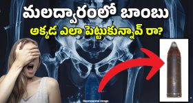 Bomb in Rectum: వీడెవడండి బాబు.. ఏకంగా బాంబునే ‘అక్కడ’ పెట్టుకున్నాడు, అది చూసి డాక్టర్లు.. పరుగులు