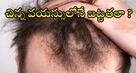 Bald Head: 30 ఏళ్లకే బట్టతలా ? మగవారు తప్పకుండా తెలుసుకోవాల్సిన నిజాలివే