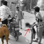 Stray Dogs Attack: సంగారెడ్డి జిల్లాలో మరోమారు రెచ్చిపోయిన వీధి కుక్కలు.. ఐదేళ్ల బాలుడిపై దారుణంగా..
