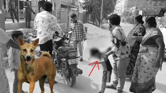 Stray Dogs Attack: సంగారెడ్డి జిల్లాలో మరోమారు రెచ్చిపోయిన వీధి కుక్కలు.. ఐదేళ్ల బాలుడిపై దారుణంగా..
