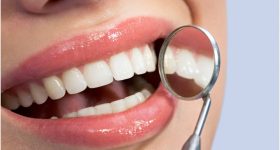 Healthy Teeth: పంటి సమస్యలా ? ఈ టిప్స్ పాటిస్తే బెస్ట్ రిజల్ట్