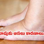 Foot Swelling Causes: కాళ్లలో వాపుకు కారణాలు.. తెలిస్తే షాక్ అవుతారు