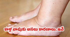 Foot Swelling Causes: కాళ్లలో వాపుకు కారణాలు.. తెలిస్తే షాక్ అవుతారు