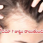 Iron Deficiency: జుట్టు పలచబడుతోందా ? ఐరన్ లోపం కావచ్చు