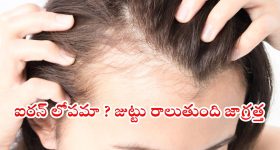 Iron Deficiency: జుట్టు పలచబడుతోందా ? ఐరన్ లోపం కావచ్చు
