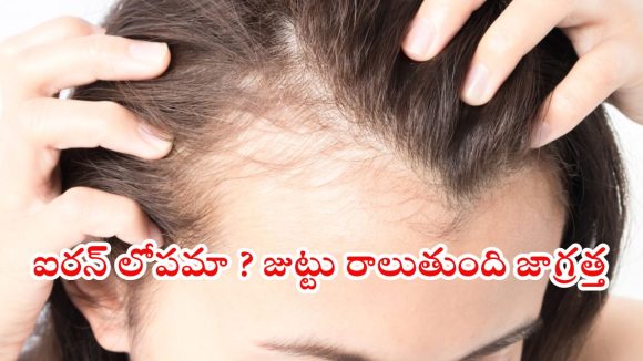 Iron Deficiency: జుట్టు పలచబడుతోందా ? ఐరన్ లోపం కావచ్చు