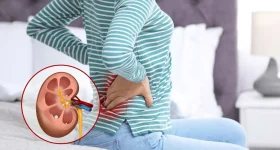 Kidney Stones: ఎండలు పెరిగితే కిడ్నీలో రాళ్లు ఎందుకు వస్తాయి? తప్పక తెలుసుకోవాల్సిన విషయాలు