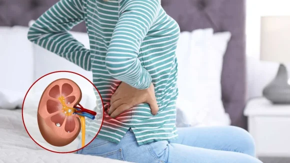 Kidney Stones: ఎండలు పెరిగితే కిడ్నీలో రాళ్లు ఎందుకు వస్తాయి? తప్పక తెలుసుకోవాల్సిన విషయాలు