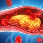 High Cholesterol: కండ్ల నుంచి కాళ్ల వరకు.. కొలెస్ట్రాల్ పెరిగితే శరీరం ఇచ్చే సంకేతాలివే!