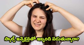 Scalp Infections: ఎక్కువగా జుట్టు రాలుతోందా ? స్కాల్ప్ ఇన్ఫెక్షన్లు కారణం కావొచ్చు