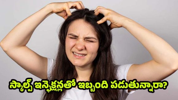 Scalp Infections: ఎక్కువగా జుట్టు రాలుతోందా ? స్కాల్ప్ ఇన్ఫెక్షన్లు కారణం కావొచ్చు