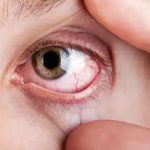 Dry Eyes Deficiency: పొడిబారిన కళ్లు, తక్కువ రోగ నిరోధక శక్తితో బాధపడుతున్నారా? శరీరంలో ఆ విటమిన్ లోపమే కారణం