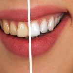 White teeth tips: దంతాలపై పసుపు గీతలు వచ్చాయా? ఈ సులభమైన చిట్కాలతో పళ్లు తెల్లగా మెరిసిపోతాయి
