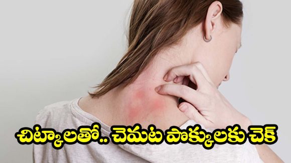 చెమట కాయలను నిమిషాల్లో తగ్గించే.. పవర్ ఫుల్ చిట్కాలు!