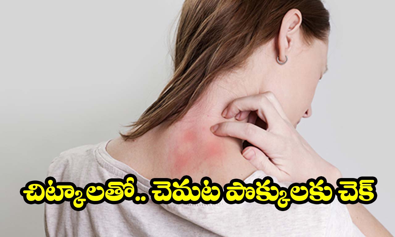 Tips for heat rash: చెమట కాయలను నిమిషాల్లో తగ్గించే.. పవర్ ఫుల్ చిట్కాలు!
