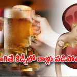 కిడ్నీలో రాళ్లా? బీరు తాగితే కరిగిపోతాయా?