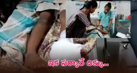 మేడారం పూజారి కొడుకు పరిస్థితి విషమం.. ఒక కాలు తొలగింపు, మరో కాలికి రాడ్ అమరిక