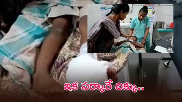 మేడారం పూజారి కొడుకు పరిస్థితి విషమం.. ఒక కాలు తొలగింపు, మరో కాలికి రాడ్ అమరిక