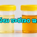 ఎండకాలంలో మూత్రం ముదురు పసుపు రంగులోకి మారుతోందా? ఇది డీహైడ్రేషనే అనుకుంటే పొరపాటే!