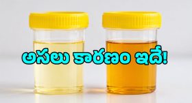 ఎండకాలంలో మూత్రం ముదురు పసుపు రంగులోకి మారుతోందా? ఇది డీహైడ్రేషనే అనుకుంటే పొరపాటే!
