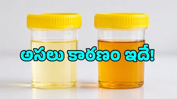ఎండకాలంలో మూత్రం ముదురు పసుపు రంగులోకి మారుతోందా? ఇది డీహైడ్రేషనే అనుకుంటే పొరపాటే!