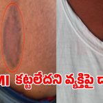 ఈఎంఐ కట్టలేదని భార్య భర్తలపై భౌతిక దాడి కలకలం
