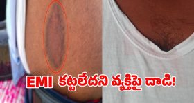 ఈఎంఐ కట్టలేదని భార్య భర్తలపై భౌతిక దాడి కలకలం