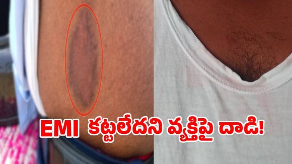 ఈఎంఐ కట్టలేదని భార్య భర్తలపై భౌతిక దాడి కలకలం