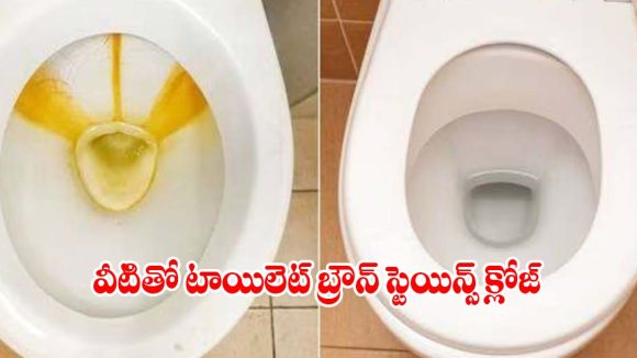 టాయిలెట్ క్లీనింగ్‌కు ఈ ఒక్కటి చాలు..15 నిమిషాల్లో గారపట్టిన మరకలన్నీ క్లీన్!