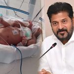 చిన్నారి ప్రాణానికి రూ. 1.5 కోట్ల ఇంజెక్షన్.. సీఎం రేవంత్ రెడ్డి సంచలన నిర్ణయం!