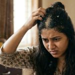చుండ్రు కారణంగా ఎప్పుడూ తలలో దురదగా ఉందా? ఇంట్లో తయారు చేసే హెయిర్ మాస్క్ ట్రై చేశారా?