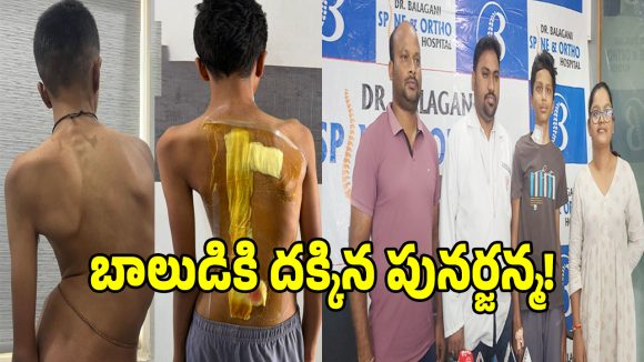 గుండ్లపోచంపల్లిలో మహా అద్భుతం.. సిద్దిపేట బాలుడికి దక్కిన పునర్జన్మ!