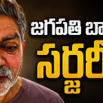 జగపతిబాబు మొహానికి సర్జరీ..? అసలు ఏమైంది..!