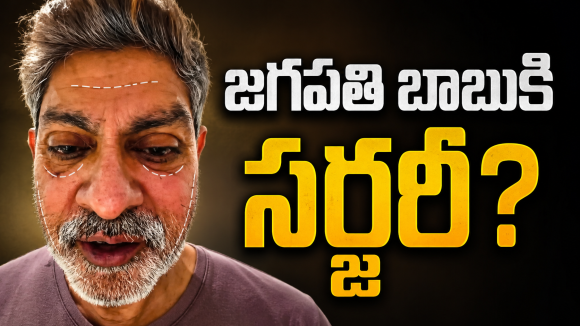 జగపతిబాబు మొహానికి సర్జరీ..? అసలు ఏమైంది..!