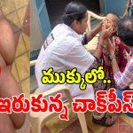 Chalk Piece: చిన్నారి ముక్కులో ఇరుక్కున్న చాక్‌పీస్.. చివరికి..