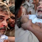 NEET లీకేజీ పై పోరుబాట.. రాహుల్ ముక్కు నుంచి రక్తం.. రంగంలోకి దిగిన సోనియా!