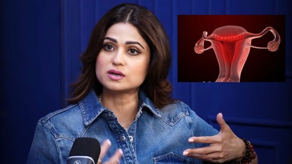 టాలీవుడ్ బ్యూటీకి ఎండోమెట్రియోసిస్.. డాక్టర్ వింత సలహా!