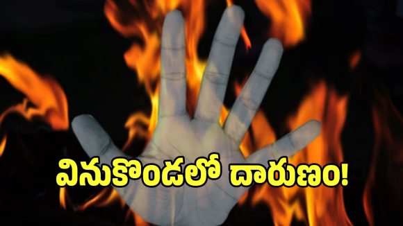 భార్యను కత్తితో బెదిరించి.. ఒంటికి నిప్పు అంటించుకున్న భర్త!