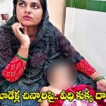 మూడేళ్ల చిన్నారిపై వీధి కుక్క దాడి.. గొంతుపై తీవ్ర గాయాలు