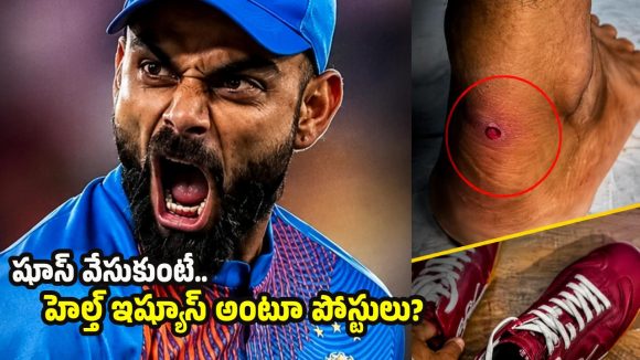 విరాట్ కోహ్లీ వన్8 షూస్ పై వివాదం.. బొబ్బ‌లు, స్కిన్ ఎల‌ర్జీలు వ‌స్తున్న‌ట్లు పోస్టులు ?