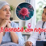 క్యాన్సర్ రీలాప్స్ అంటే ఏమిటి? చికిత్స తర్వాత మళ్లీ క్యాన్సర్ రావడానికి అసలు కారణాలివే!